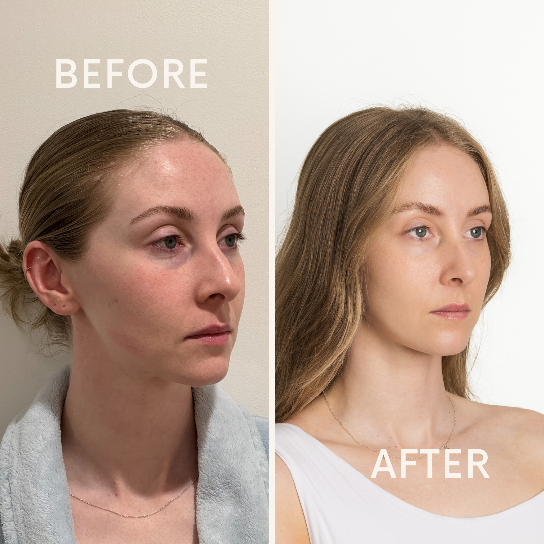 LUMINA LED FACE MASK