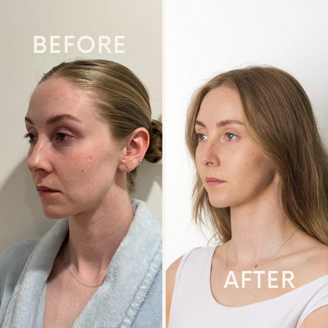 LUMINA LED FACE MASK