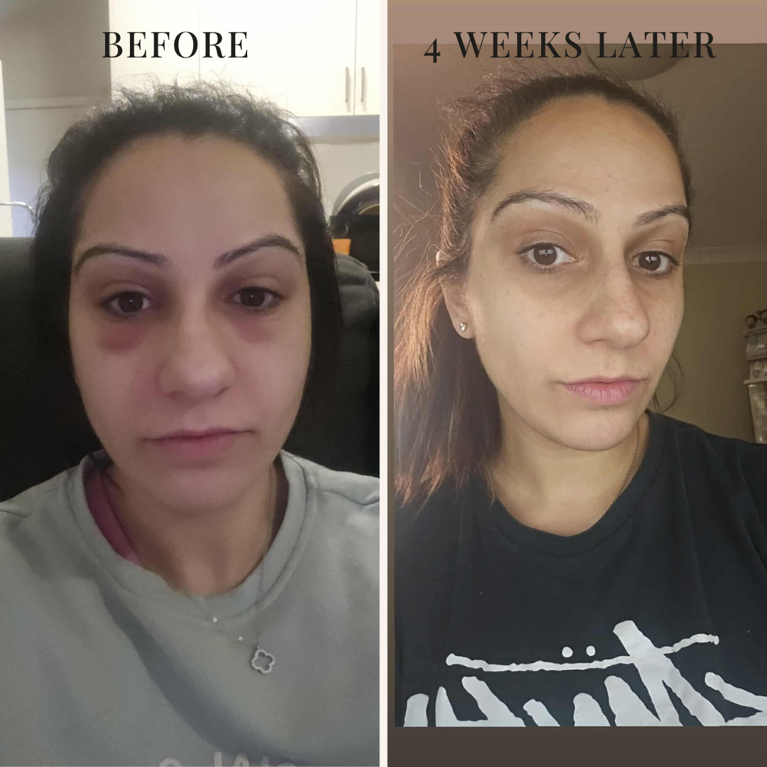 LUMINA LED FACE MASK